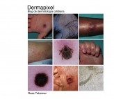 Dermapixel: Blog de dermatología cotidiana